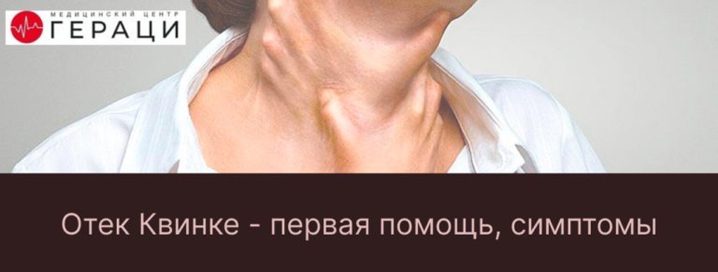 Отек Квинке — первая помощь, симптомы